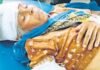 भरभराकर गिरी जर्जर दीवार,मलवे में दबकर महिला हुई गंभीर घायल,अस्पताल में भर्ती