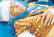 भरभराकर गिरी जर्जर दीवार,मलवे में दबकर महिला हुई गंभीर घायल,अस्पताल में भर्ती